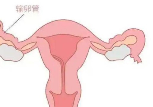 人工授精只是一项小手术，并不会让女性觉得痛